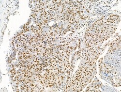 Invitrogen Acetyl-p53 (Lys373) Polyclonal Antibody 100 &mu;L; Unconjugated:Antibodies,