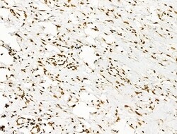 Invitrogen Acetyl-p53 (Lys373) Polyclonal Antibody 100 &mu;L; Unconjugated:Antibodies,