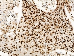Invitrogen Acetyl-p53 (Lys373) Polyclonal Antibody 100 &mu;L; Unconjugated:Antibodies,