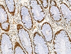 Invitrogen Acetyl-p53 (Lys373) Polyclonal Antibody 100 &mu;L; Unconjugated:Antibodies,