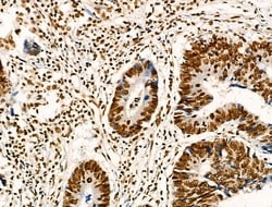 Invitrogen Acetyl-p53 (Lys373) Polyclonal Antibody 100 &mu;L; Unconjugated:Antibodies,