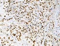 Invitrogen Acetyl-p53 (Lys373) Polyclonal Antibody 100 &mu;L; Unconjugated:Antibodies,