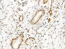 Invitrogen Acetyl-p53 (Lys373) Polyclonal Antibody 100 &mu;L; Unconjugated:Antibodies,