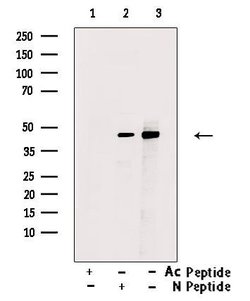 Acetyl-p53 (Lys381) Polyclonal Antibody 100 &mu;L | Buy Online | Thermo Scientific | Fisher Scientific