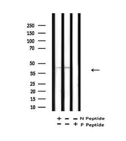 Acetyl-p53 (Lys381) Polyclonal Antibody 100 &mu;L | Buy Online | Thermo Scientific | Fisher Scientific
