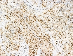 Acetyl-p53 (Lys381) Polyclonal Antibody 100 &mu;L | Buy Online | Thermo Scientific | Fisher Scientific