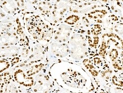 Acetyl-p53 (Lys381) Polyclonal Antibody 100 &mu;L | Buy Online | Thermo Scientific | Fisher Scientific