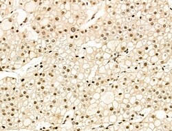 Acetyl-p53 (Lys381) Polyclonal Antibody 100 &mu;L | Buy Online | Thermo Scientific | Fisher Scientific