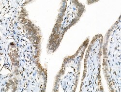 Acetyl-p53 (Lys381) Polyclonal Antibody 100 &mu;L | Buy Online | Thermo Scientific | Fisher Scientific