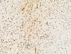 Acetyl-p53 (Lys381) Polyclonal Antibody 100 &mu;L | Buy Online | Thermo Scientific | Fisher Scientific