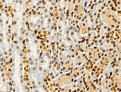 Acetyl-p53 (Lys381) Polyclonal Antibody 100 &mu;L | Buy Online | Thermo Scientific | Fisher Scientific