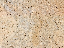 Acetyl-p53 (Lys381) Polyclonal Antibody 100 &mu;L | Buy Online | Thermo Scientific | Fisher Scientific