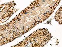 Acetyl-p53 (Lys381) Polyclonal Antibody 100 &mu;L | Buy Online | Thermo Scientific | Fisher Scientific