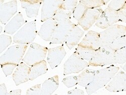 Acetyl-p53 (Lys381) Polyclonal Antibody 100 &mu;L | Buy Online | Thermo Scientific | Fisher Scientific