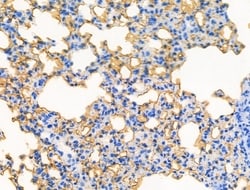 Invitrogen Phospho-Oxytocin Receptor (Thr235) Polyclonal Antibody 100 &mu;L;