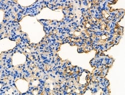 Invitrogen Phospho-Oxytocin Receptor (Thr235) Polyclonal Antibody 100 &mu;L;