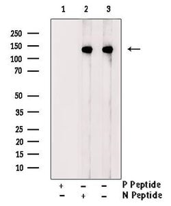 Invitrogen Phospho-ATP Citrate Lyase (Ser455, Ser457) Polyclonal Antibody 100 &mu;L | Buy Online | Invitrogen&trade; | Fisher Scientific