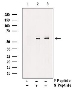 Invitrogen Phospho-IRAK4 (Thr342) Polyclonal Antibody 100 &mu;L; Unconjugated:Antibodies,