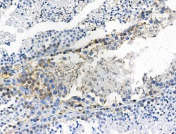 Invitrogen Phospho-LAT (Tyr220) Polyclonal Antibody 100 &mu;L; Unconjugated:Antibodies,