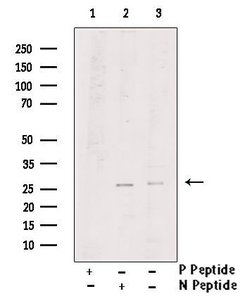 Invitrogen Phospho-LAT (Tyr220) Polyclonal Antibody 100 &mu;L; Unconjugated:Antibodies,