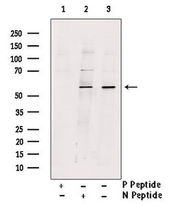 Invitrogen Phospho-DOK2 (Tyr345) Polyclonal Antibody 100 &mu;L | Buy Online | Invitrogen&trade; | Fisher Scientific
