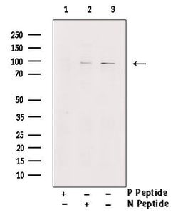 Invitrogen Phospho-INSR (Tyr1355) Polyclonal Antibody 100 &mu;L; Unconjugated:Antibodies,