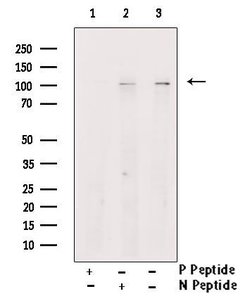 Invitrogen Phospho-CSF1R (Tyr699) Polyclonal Antibody 100 &mu;L; Unconjugated:Antibodies,