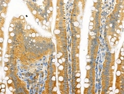 Invitrogen Phospho-CSF1R (Tyr708) Polyclonal Antibody 100 &mu;L; Unconjugated:Antibodies,