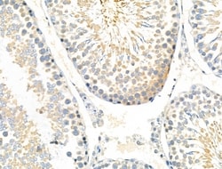 Invitrogen Phospho-CSF1R (Tyr708) Polyclonal Antibody 100 &mu;L; Unconjugated:Antibodies,