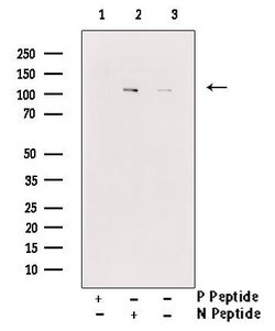 Invitrogen Phospho-CSF1R (Tyr708) Polyclonal Antibody 100 &mu;L; Unconjugated:Antibodies,