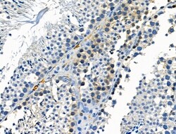 Invitrogen Phospho-CSF1R (Tyr723) Polyclonal Antibody 100 &mu;L; Unconjugated:Antibodies,