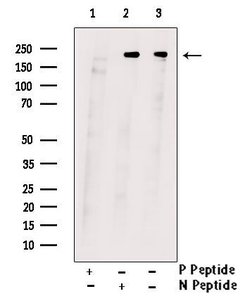 Invitrogen Phospho-PDGFRB (Tyr751) Polyclonal Antibody 100 &mu;L | Buy Online | Invitrogen&trade; | Fisher Scientific