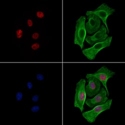 Invitrogen Phospho-ALOX5 (Ser272) Polyclonal Antibody 100 &mu;L | Buy Online | Invitrogen&trade; | Fisher Scientific