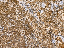 Invitrogen Phospho-Bcl-2 (Thr56) Polyclonal Antibody 100 &mu;L; Unconjugated:Antibodies,