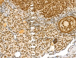 Invitrogen Phospho-Bcl-2 (Thr56) Polyclonal Antibody 100 &mu;L; Unconjugated:Antibodies,