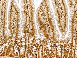 Invitrogen Phospho-Bcl-2 (Thr56) Polyclonal Antibody 100 &mu;L; Unconjugated:Antibodies,