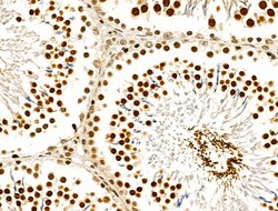 Invitrogen Phospho-Bcl-2 (Thr56) Polyclonal Antibody 100 &mu;L; Unconjugated:Antibodies,