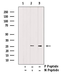 Invitrogen Phospho-Bcl-2 (Thr56) Polyclonal Antibody 100 &mu;L; Unconjugated:Antibodies,