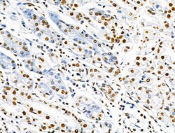 Invitrogen Phospho-SRF (Ser103) Polyclonal Antibody 100 &mu;L; Unconjugated:Antibodies,