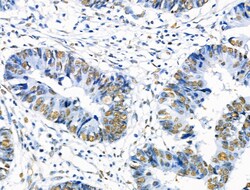 Invitrogen Phospho-SRF (Ser103) Polyclonal Antibody 100 &mu;L; Unconjugated:Antibodies,