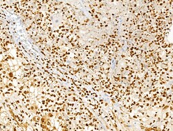 Invitrogen Phospho-SRC (Ser17) Polyclonal Antibody 100 &mu;L | Buy Online | Invitrogen&trade; | Fisher Scientific