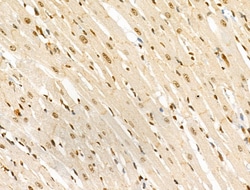 Invitrogen Phospho-SRC (Ser17) Polyclonal Antibody 100 &mu;L | Buy Online | Invitrogen&trade; | Fisher Scientific