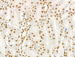 Invitrogen Phospho-SRC (Ser17) Polyclonal Antibody 100 &mu;L | Buy Online | Invitrogen&trade; | Fisher Scientific