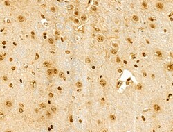 Invitrogen Phospho-SRC (Ser17) Polyclonal Antibody 100 &mu;L | Buy Online | Invitrogen&trade; | Fisher Scientific