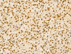 Invitrogen Phospho-SRC (Ser17) Polyclonal Antibody 100 &mu;L | Buy Online | Invitrogen&trade; | Fisher Scientific