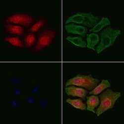 Invitrogen Phospho-Ku70 (Ser520) Polyclonal Antibody 100 &mu;L; Unconjugated:Antibodies,