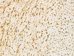 Phospho-Desmoplakin (Ser165, Ser166) Polyclonal Antibody, Invitrogen 100 &mu;L | Buy Online | Thermo Scientific | Fisher Scientific