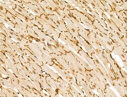 Phospho-Desmoplakin (Ser165, Ser166) Polyclonal Antibody, Invitrogen 100 &mu;L | Buy Online | Thermo Scientific | Fisher Scientific