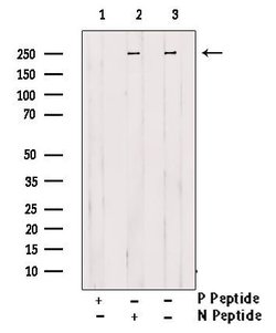 Phospho-Desmoplakin (Ser165, Ser166) Polyclonal Antibody, Invitrogen 100 &mu;L | Buy Online | Thermo Scientific | Fisher Scientific