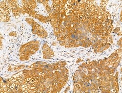 Invitrogen Phospho-NR4A1 (Ser351) Polyclonal Antibody 100 &mu;L; Unconjugated:Antibodies,